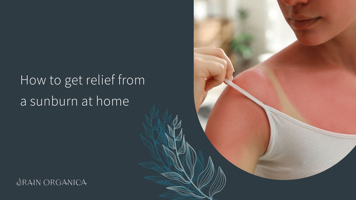 How to treat a sunburn at home