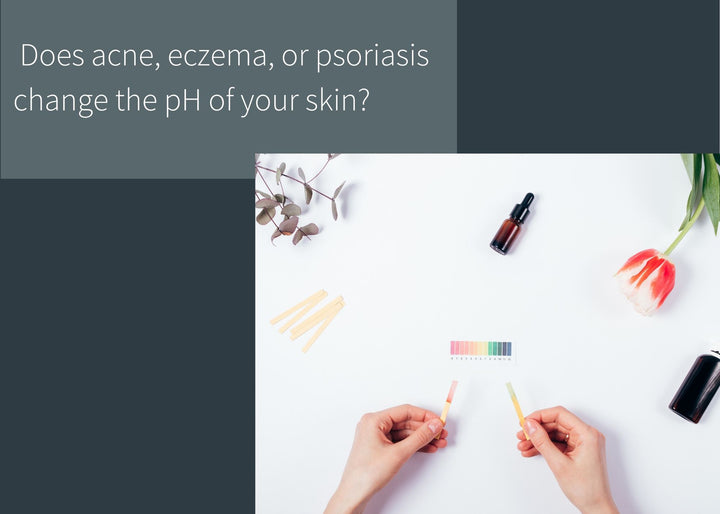 Why don't children get acne?  What your skin's pH has to do with acne, eczema, and psoriasis